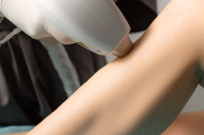 Laser Hair Removal in Riyadh: Is It Worth the Investment?
